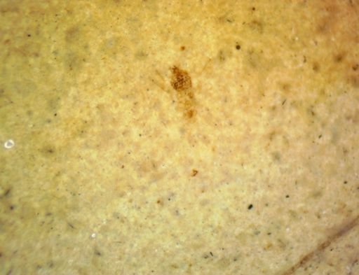 undet. Hexapoda