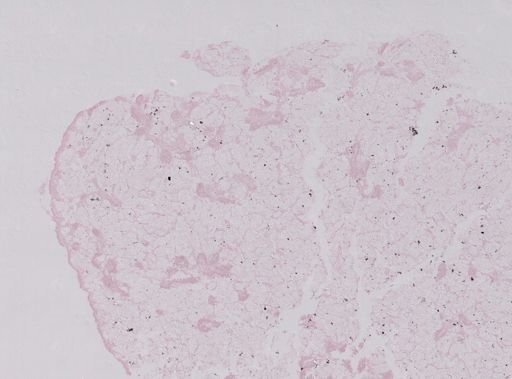Modiolus