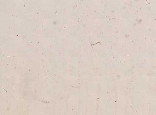 Plasmodium falciparum