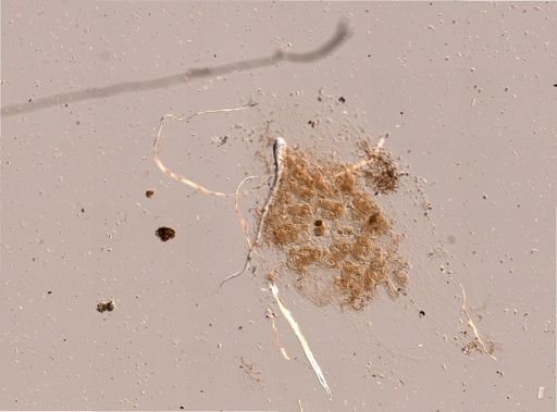 Torquatella dissimilis
