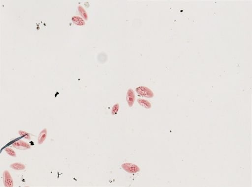 Paramecium calkinsi