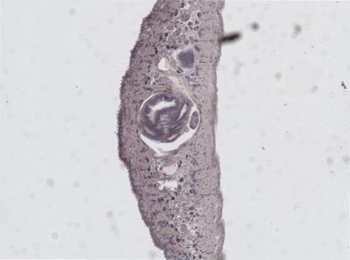 Glossiphonia