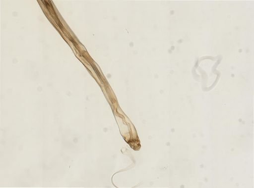 Myopsida