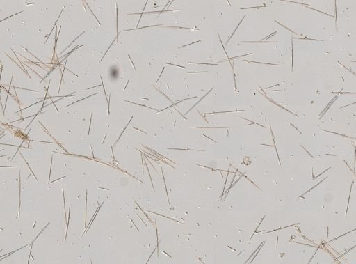 Esperiopsis?