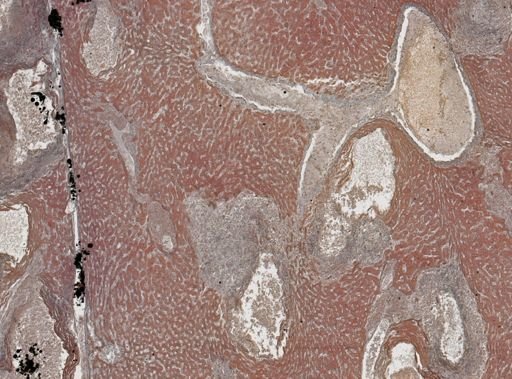 Taenia crassicollis