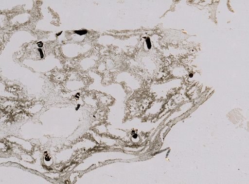 cf. Spongionella