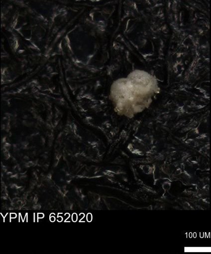 undet. Foraminiferida