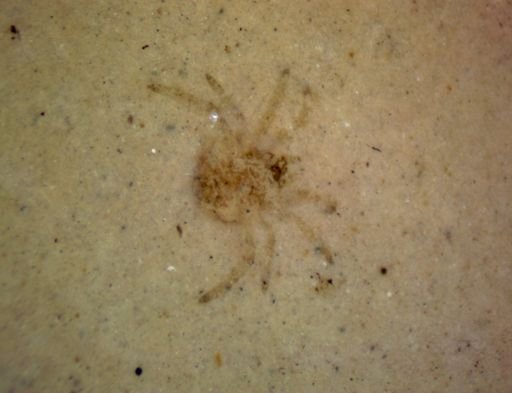 undet. Araneae