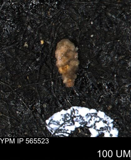 Verneuilina canadensis