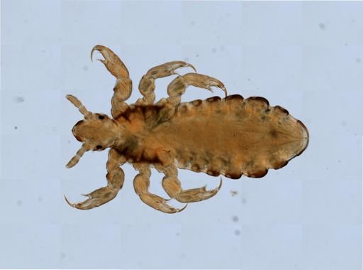 Pediculus humanus