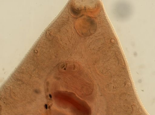Fasciola hepatica