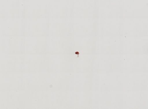 Trematoda
