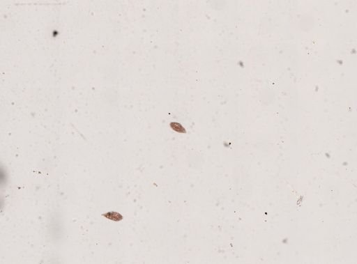Paramecium caudatum