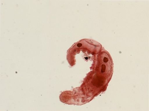 Chaetogaster limnaei