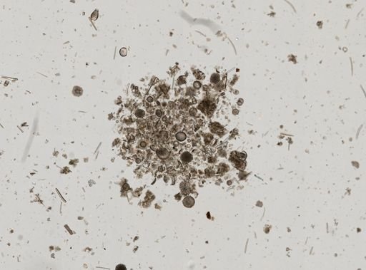 Radiolaria