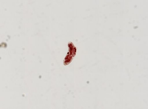 Trematoda