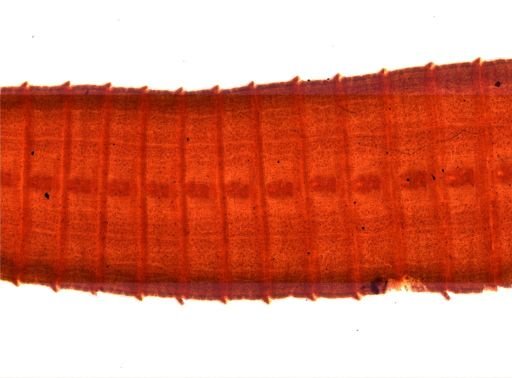 Diphyllobothrium erinacei