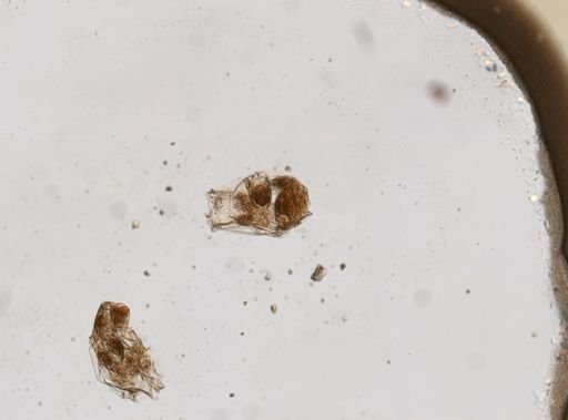 Asplanchna priodonta