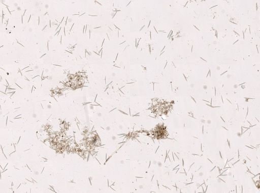 Haliclona oculata