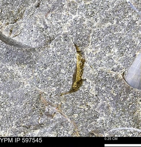 Protocardia?