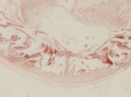 Ascaris megalocephala