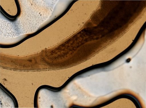 Trichuris trichiura