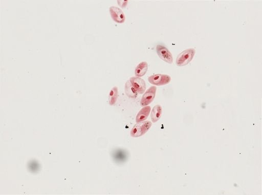 Paramecium