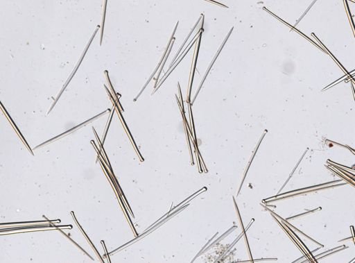 Suberites sp.