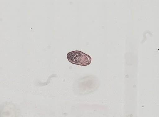 Plagiostomum whitmani