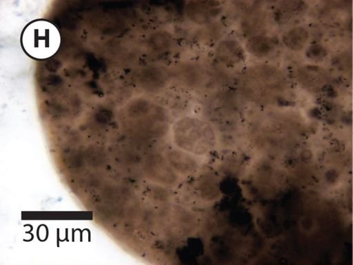 Megasphaera miniscula