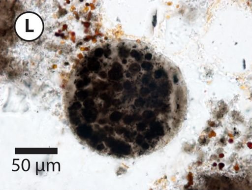Megasphaera miniscula