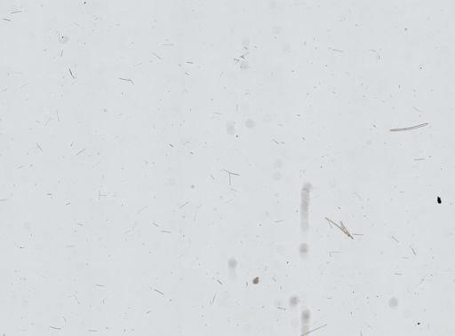 Callyspongia vaginalis