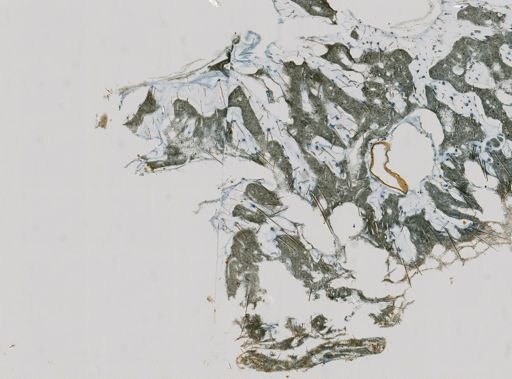 Stromatospongia vermicola