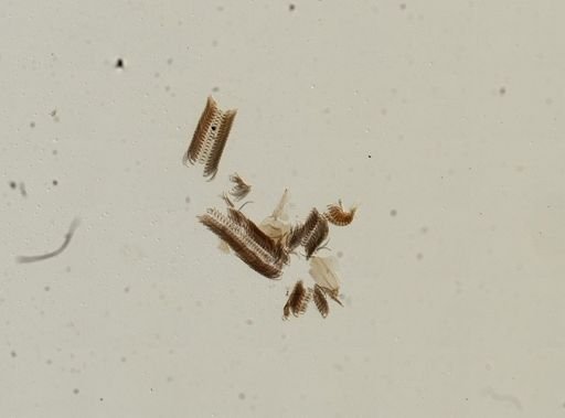 Bithynia tentaculata