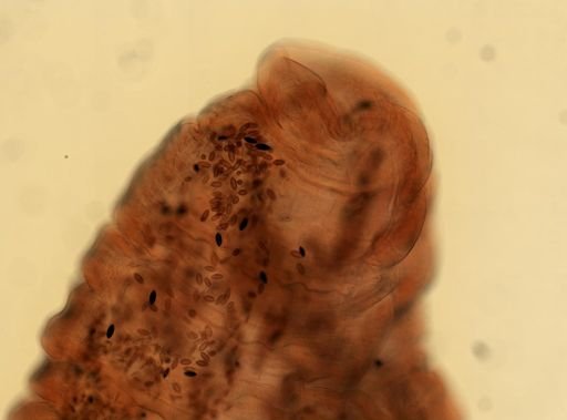 Oligacanthorhynchus microcephalus