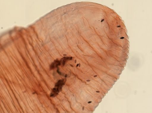 Oligacanthorhynchus microcephalus