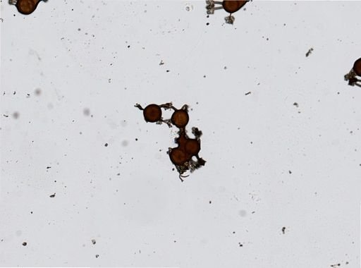 Microsphaera