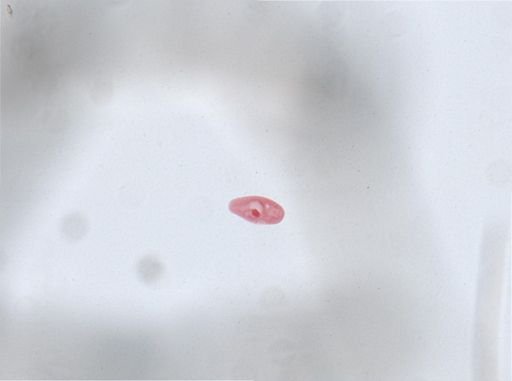 Paramecium aurelia