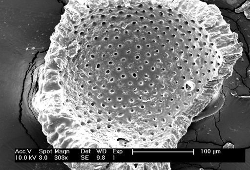 Globigerinoides sacculifer