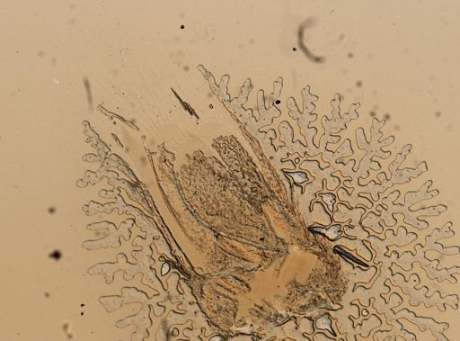 Chiridotea coeca