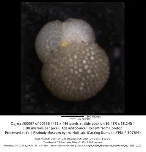 Globigerinoides sacculifer