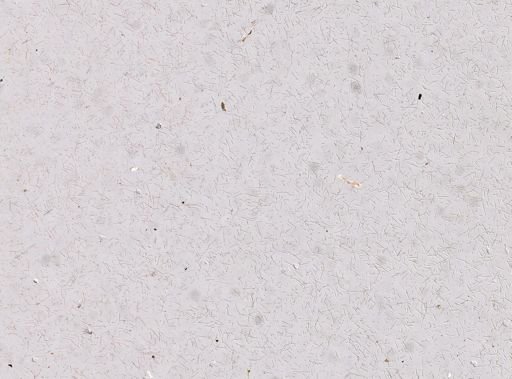 Amphimedon complanata