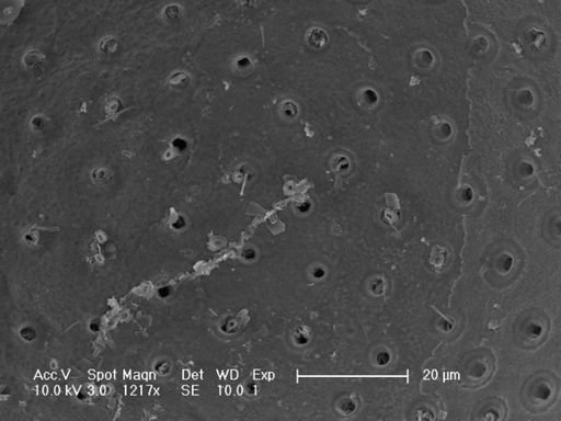 Globorotalia inflata