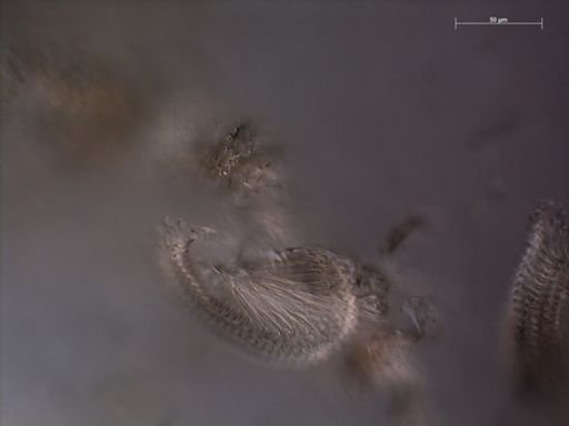 Rosacea cymbiformis