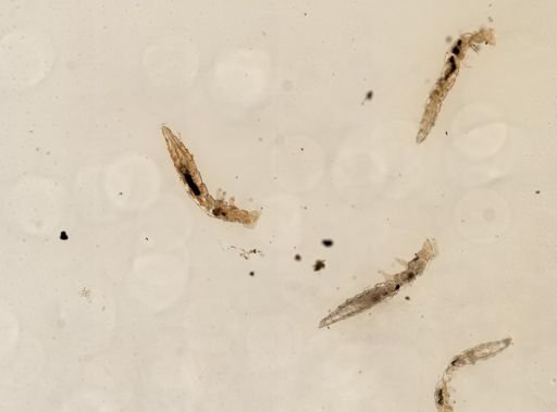 Gracilentulus nr. floridanus