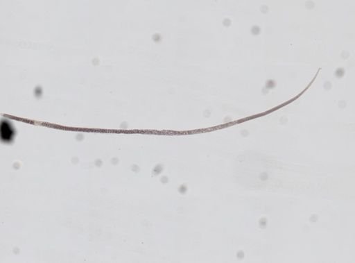 Trichinella spiralis