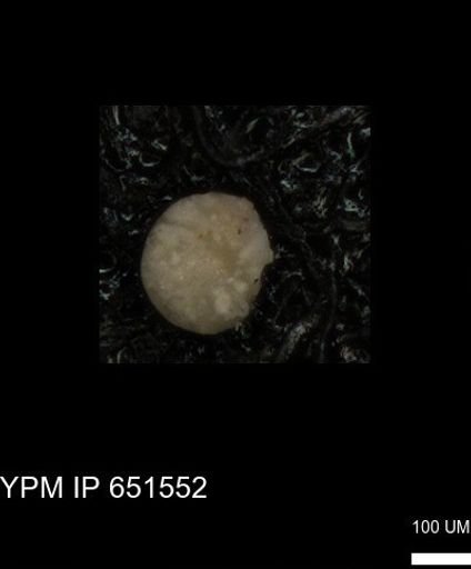 undet. Foraminiferida