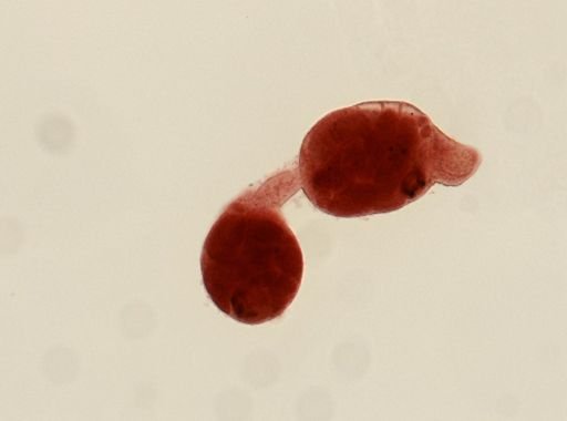 Digenea