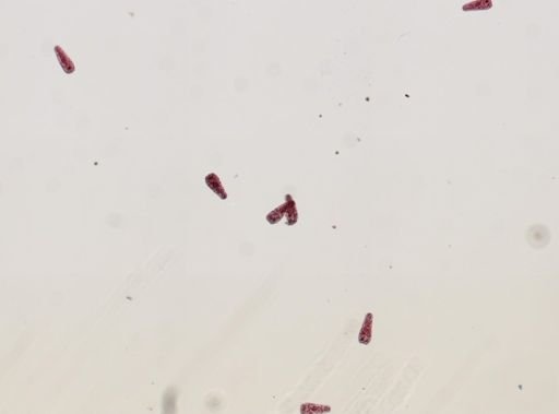 Fasciola hepatica