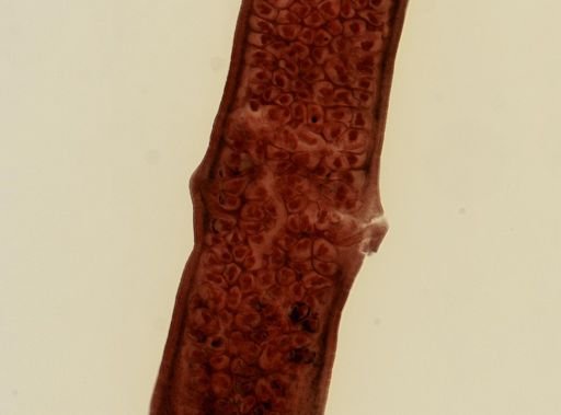 Dipylidium caninum